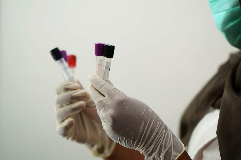 La concentración global de partículas de plástico en la sangre de los 22 donantes ascendía a una media de 1,6 microgramos por mililitro